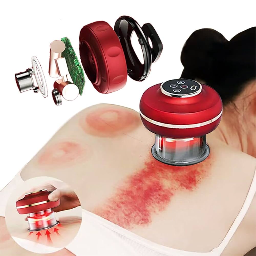 Electric Vacuum Cupping Massage